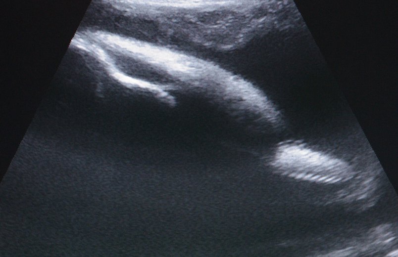 Ultraschallbild von der schwangeren Sunny