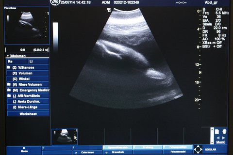 Ultraschallbild von der schwangeren Sunny